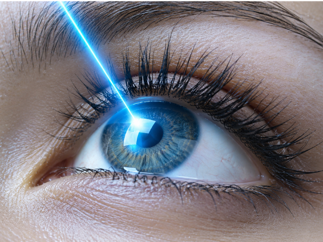 Lasik
